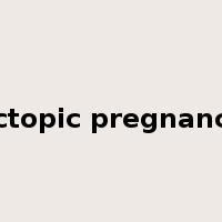 ectopic pregnancy是什么意思