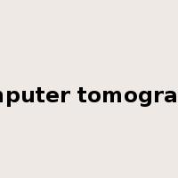computer tomography是什么意思