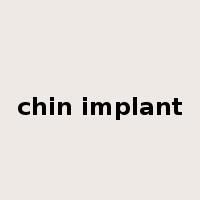 chin implant是什么意思