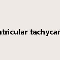ventricular tachycardia是什么意思