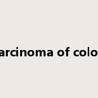 carcinoma of colon是什么意思