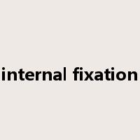 internal fixation是什么意思