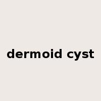 dermoid cyst是什么意思