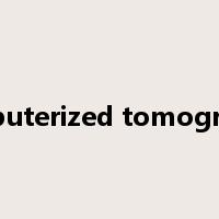 computerized tomography是什么意思