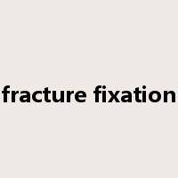fracture fixation是什么意思