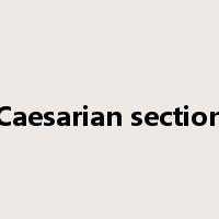 Caesarian section是什么意思